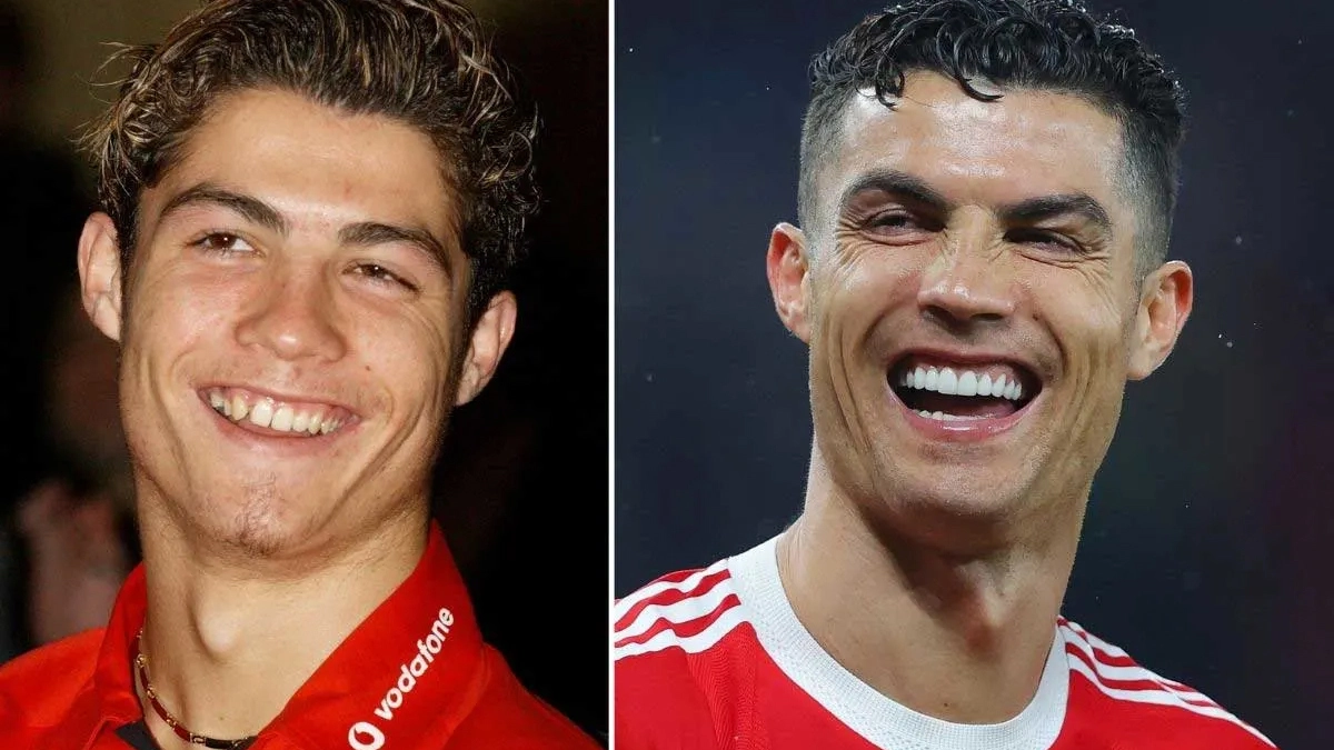 What Are The Dental Treatments Applied To Cristiano Ronaldo?